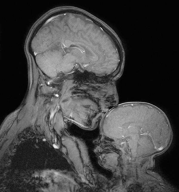 Una resonancia magnética muestra una vista lateral en blanco y negro de un adulto y un bebé abrazados. Se ven sus cerebros, cuellos y hombros.