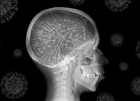 Covid y el cerebro: Una crisis de salud neurológica