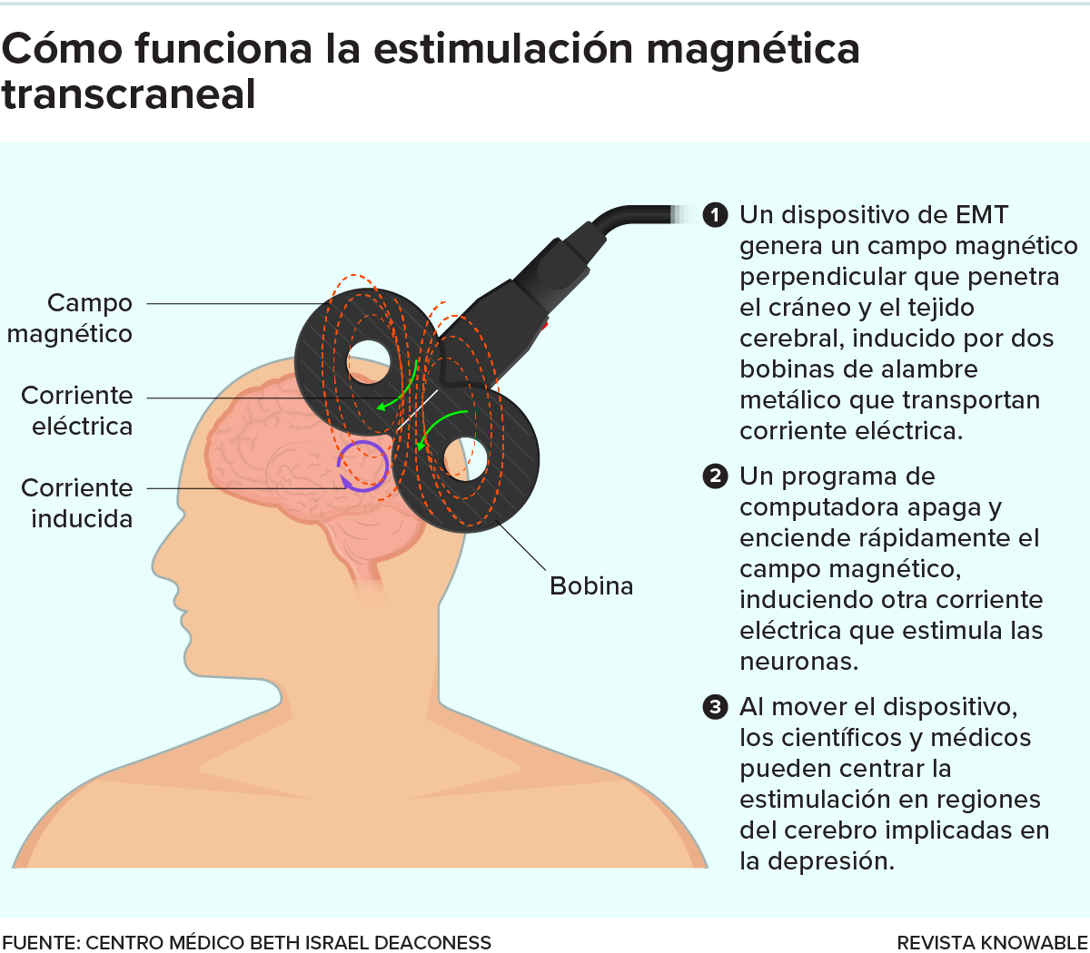 Una ilustración muestra un dispositivo plano de EMT colocado sobre el lado izquierdo de la cabeza de una persona, emitiendo un campo magnético perpendicular.