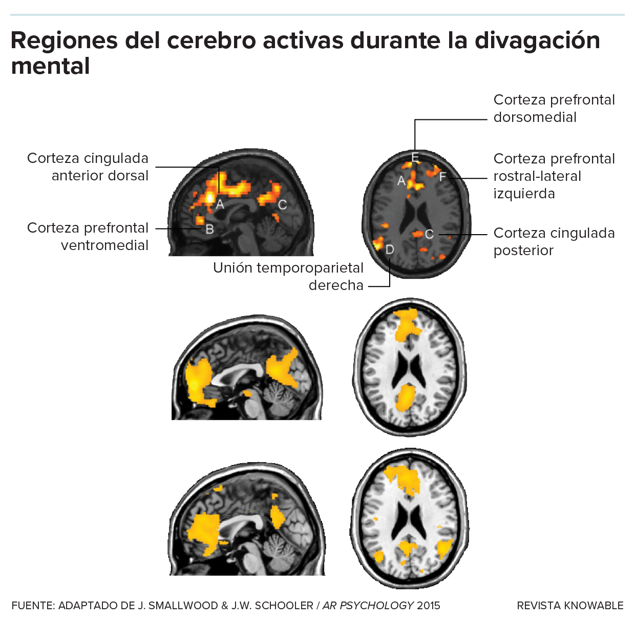 Seis imágenes grises de resonancia magnética funcional del cerebro con puntos activos iluminados en rojo y amarillo.