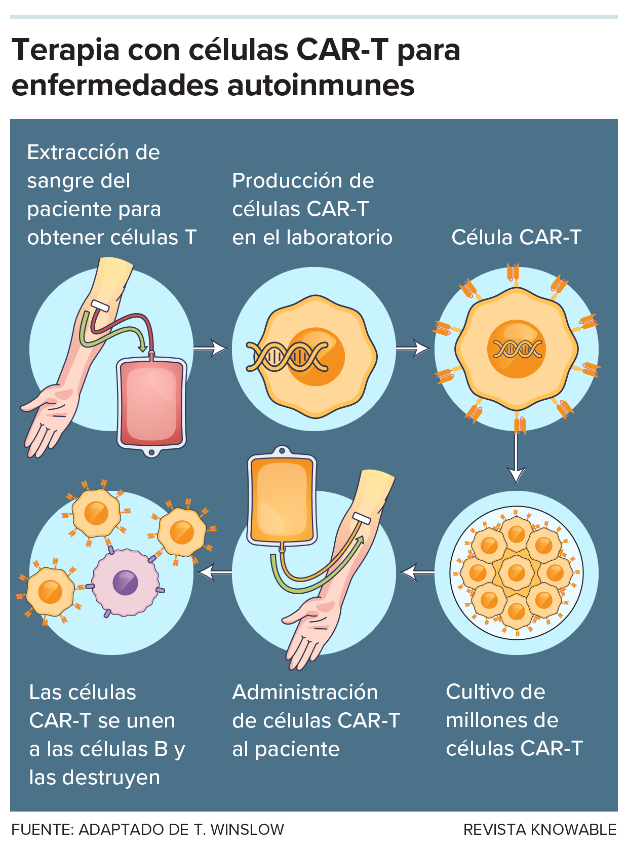 Terapia con células CAR-T para enfermedades autoinmunes Un diagrama muestra el procedimiento de la terapia CAR-T, que comienza con la extracción de sangre del paciente, seguida de la reprogramación genética de los linfocitos T para convertirlos en células CAR-T, las cuales se cultivan y luego se reinyectan al paciente, donde se unen a los linfocitos B y los destruyen.