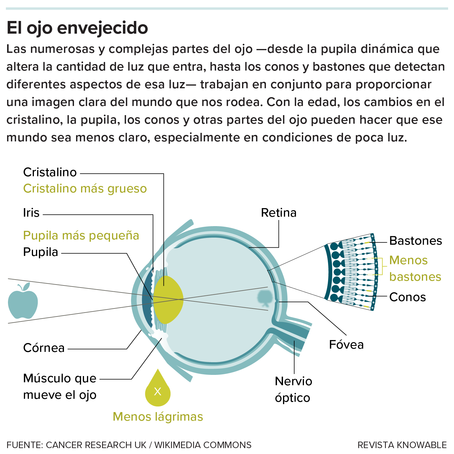Gráfico que muestra los cambios que sufre el ojo con la edad.