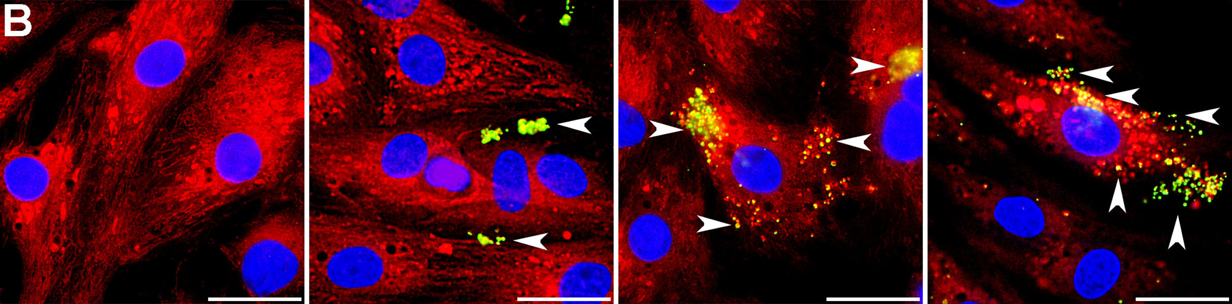 Imágenes microscópicas muestran mitocondrias que han sido trasplantadas al tejido cardíaco de ratas entrando en las células.