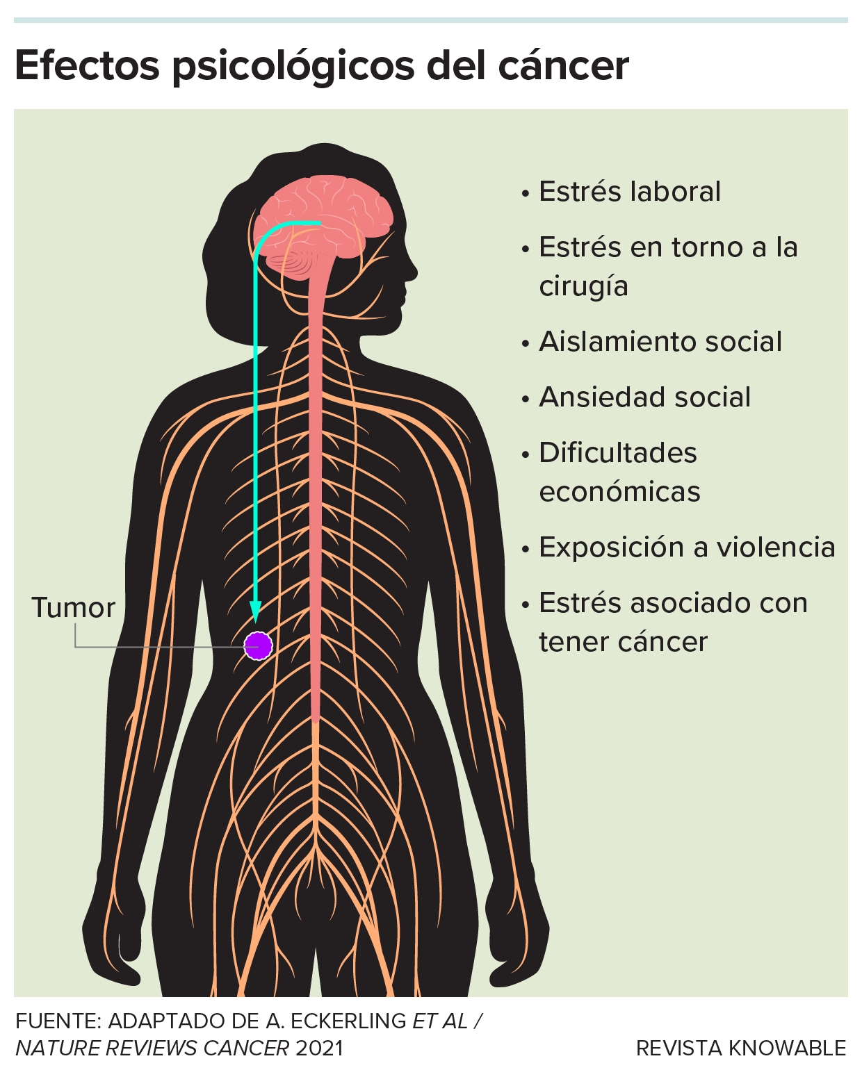 Efectos del estrés en el cáncer Esquema de una persona mostrando su sistema nervioso, cerebro y tumor muestra una lista de posibles factores estresantes que pueden afectar al crecimiento del tumor.