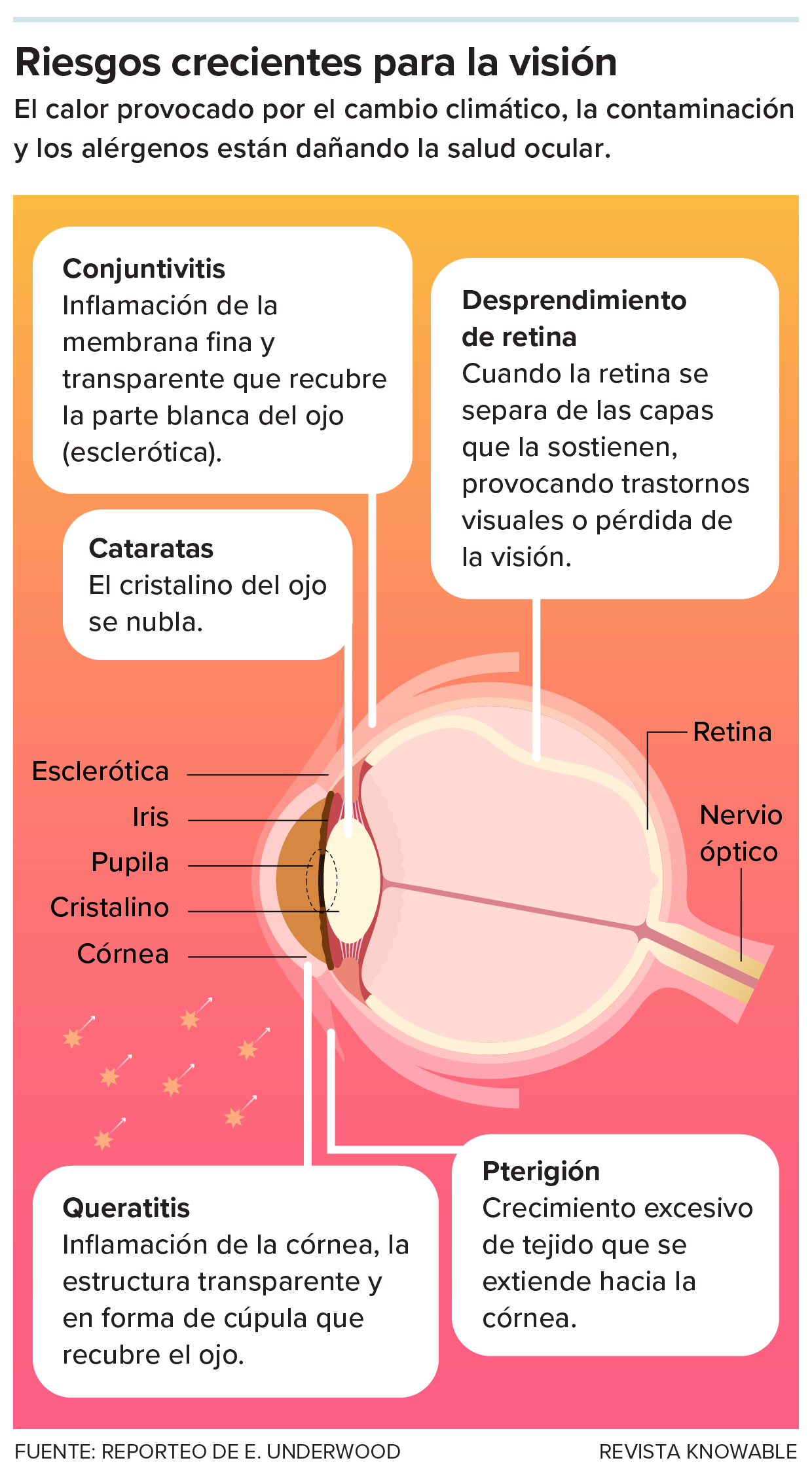 Cómo afectan al ojo el calor, la contaminación y los alérgenos Diagrama lateral de un ojo con anatomía etiquetada, junto a una lista de afecciones oculares relacionadas con el calor, la contaminación y los alérgenos provocados por el clima.