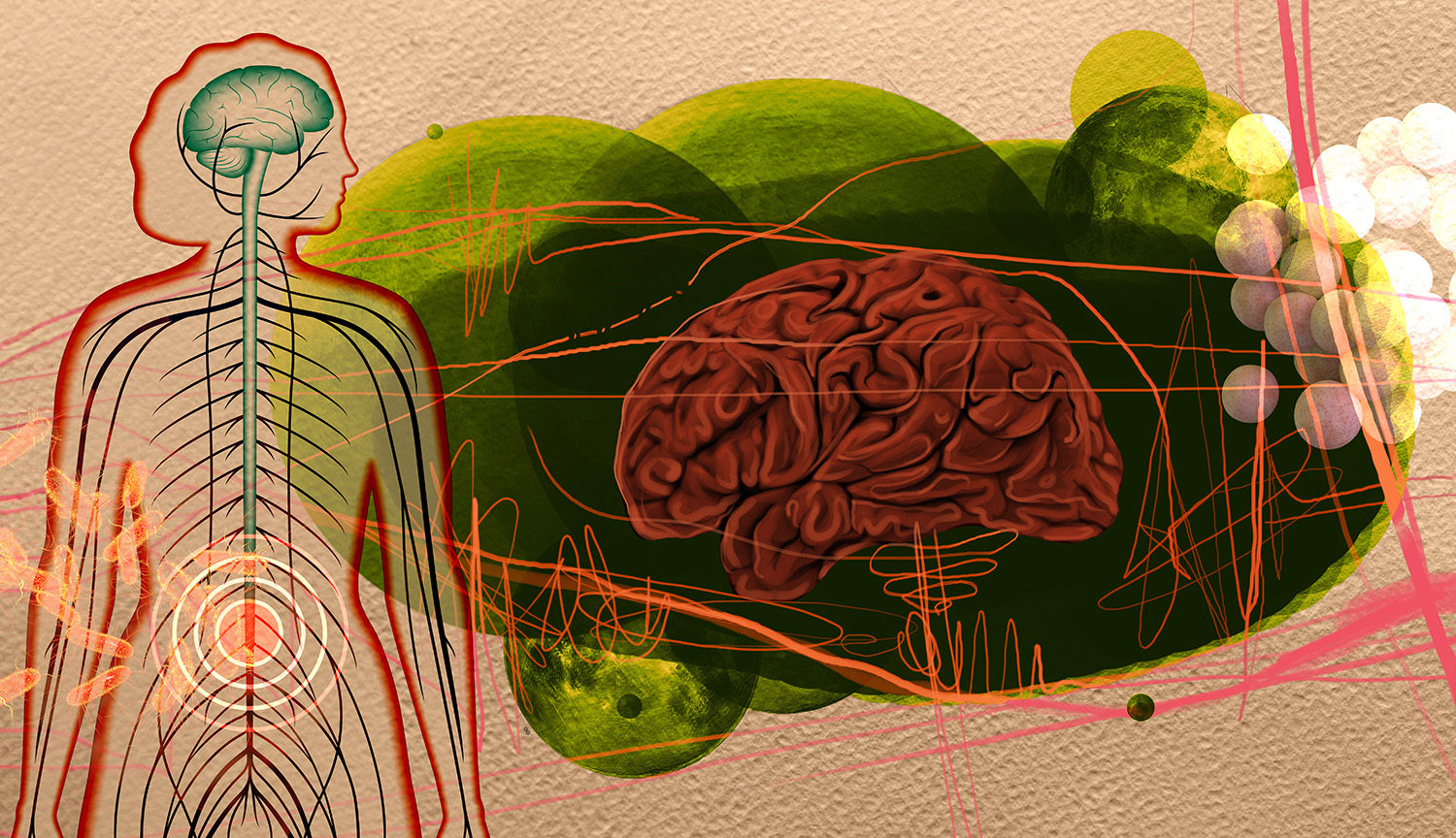 Collage representa microbios, el cerebro, el cuerpo humano y las células nerviosas.