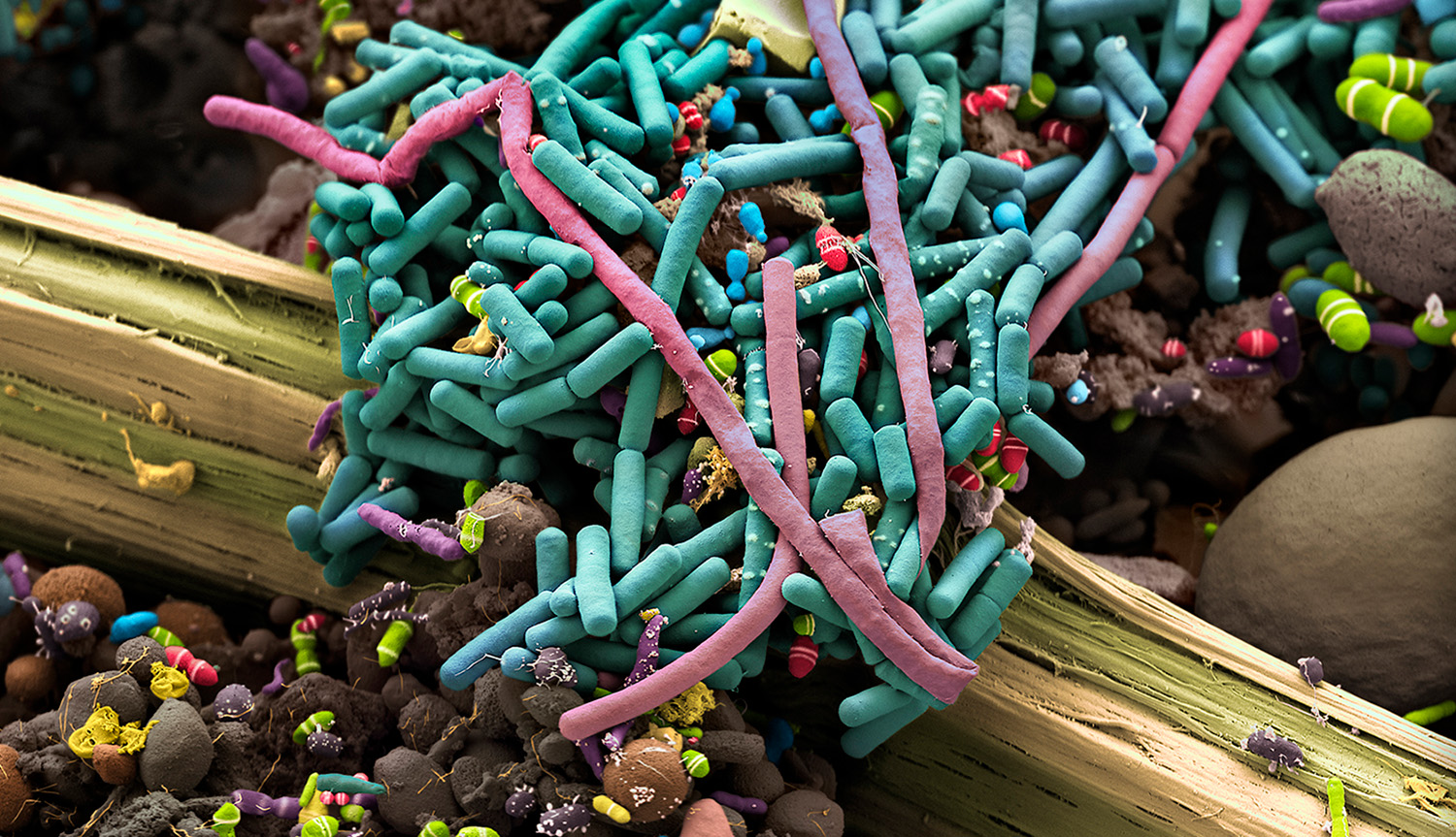 Una imagen colorizada de un excremento obtenida con un microscopio electrónico de barrido muestra un trozo de fibra vegetal de color verde pálido cubierto por diminutos microbios de colores verde azulado, púrpura, rojo, verde y marrón, entre otros.