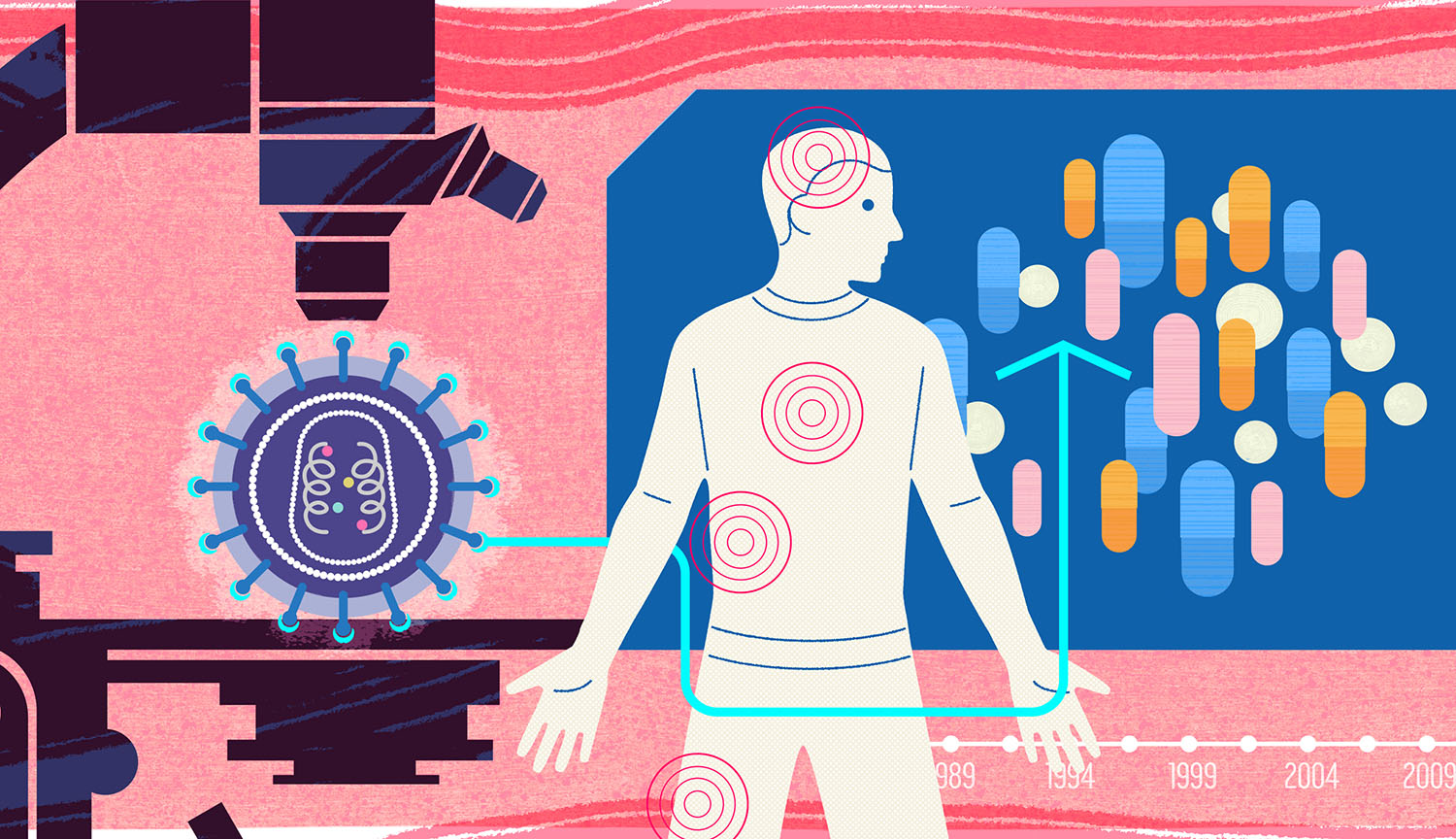 El virus VIH, una persona infectada, imágenes de píldoras y un microscopio.