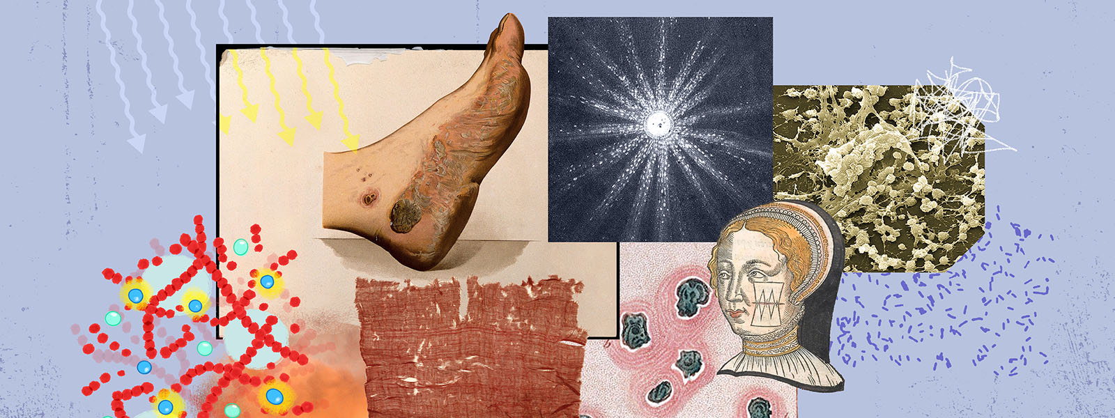 Ilustración que muestra heridas infectadas, bacterias y luz.