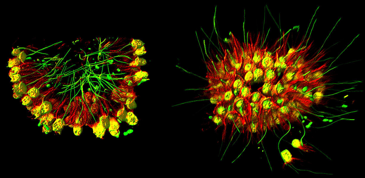 Una micrografía muestra formas de vida unicelulares con colas pegadas formando colonias.