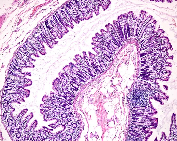 Una imagen de microscopía en color rosa y violeta de la superficie interior del colon.