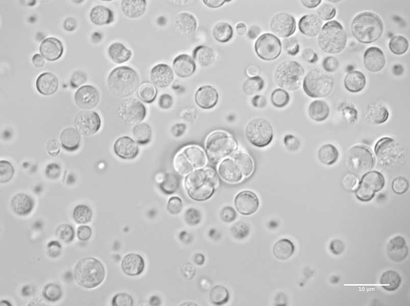 Una micrografía en escala de grises muestra células individuales y agrupadas.