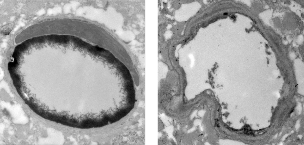 Imágenes de microscopio electrónico que muestran dos capilares circulares, uno al lado del otro. El revestimiento interno del capilar de la izquierda es más grueso.