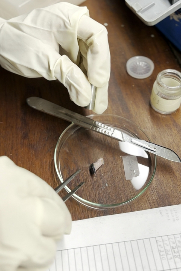 La fotografía muestra las manos de una persona con guantes de látex manipulando un pequeño trozo de tejido en una placa de Petri.