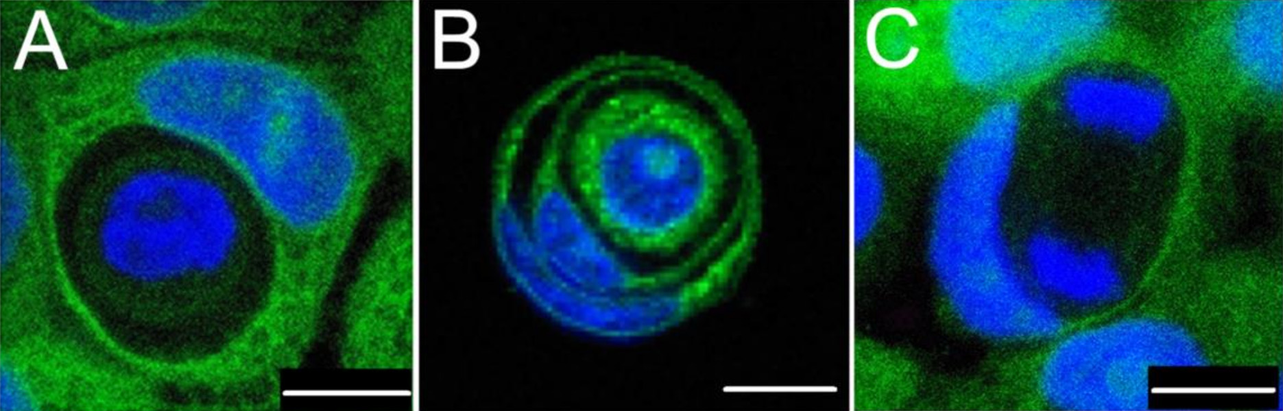 Tres imágenes generadas por microscopio muestran células dentro de otras células