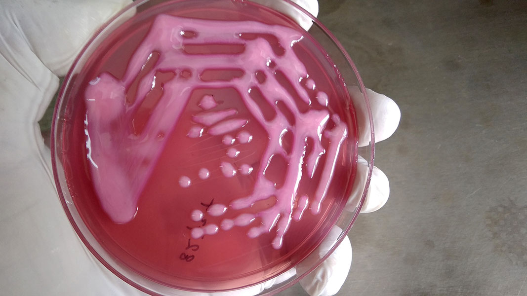 Cultivo de Klebsiella Una mano enguantada sostiene una placa de Petri con colonias bacterianas de color rosa.