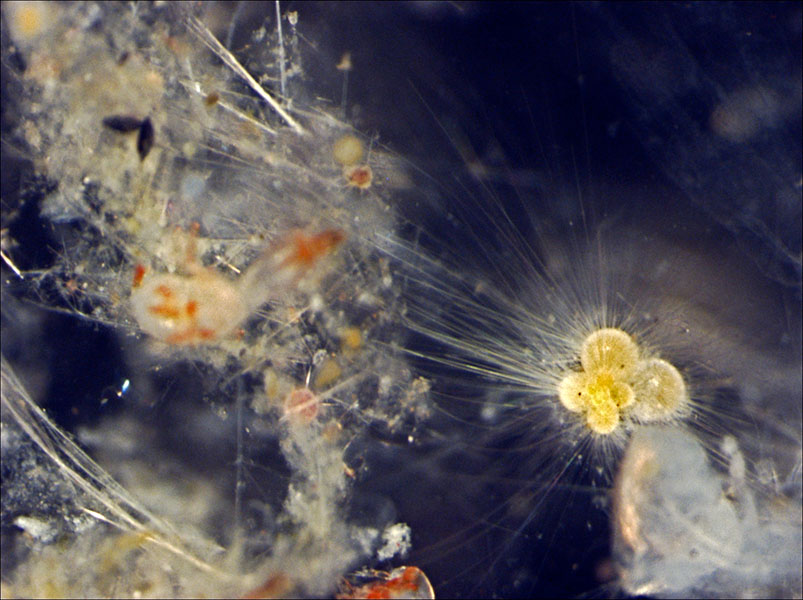 Globigerinella calida Una fotografía de un foraminífero vivo muestra su forma: parece una serie de estructuras similares a globos terráqueos pegados entre sí. También son visibles las delgadas estructuras en forma de tentáculos que salen de los orificios de su caparazón a bastante distancia.