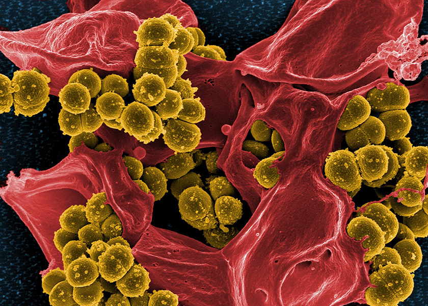 Micrografía coloreada que muestra bacterias resistentes a los antibióticos rodeando una célula sanguínea muerta.