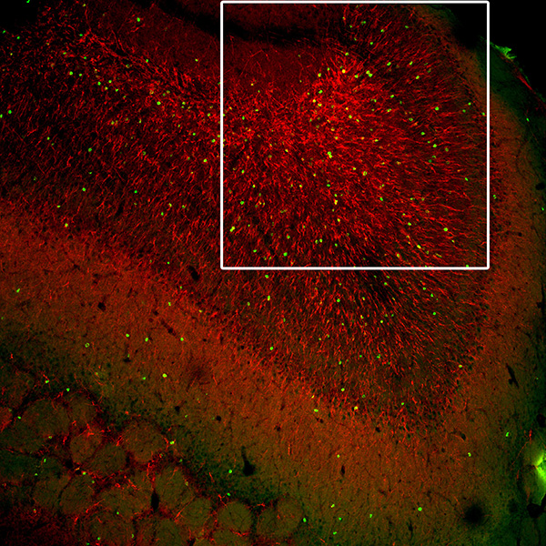 Neuronas del bulbo olfativo Imagen microscópica de las neuronas del bulbo olfativo.