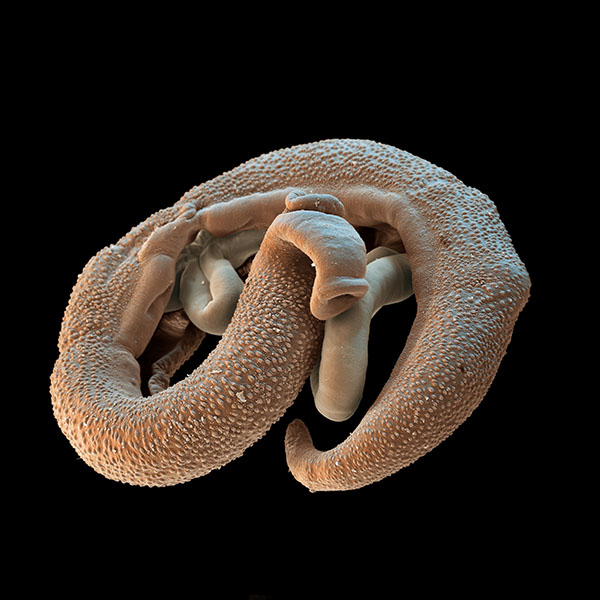 Trematodos Primer plano de dos gusanos entrelazados.