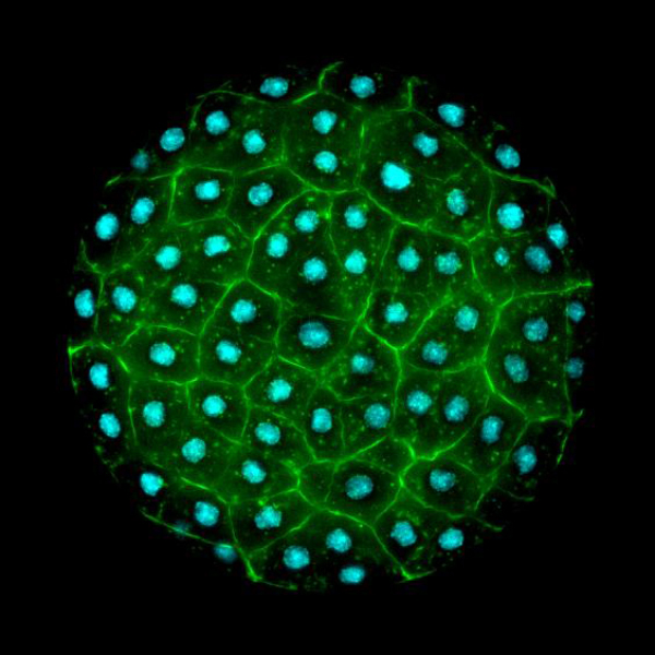 Una micrografía muestra una bola de células agrupadas, con un colorante azul tiñendo sus núcleos.