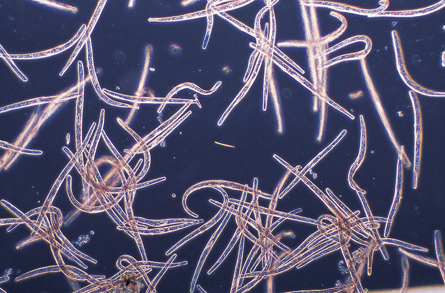 Microbios largos y delgados pueblan el campo de visión del microscopio.
