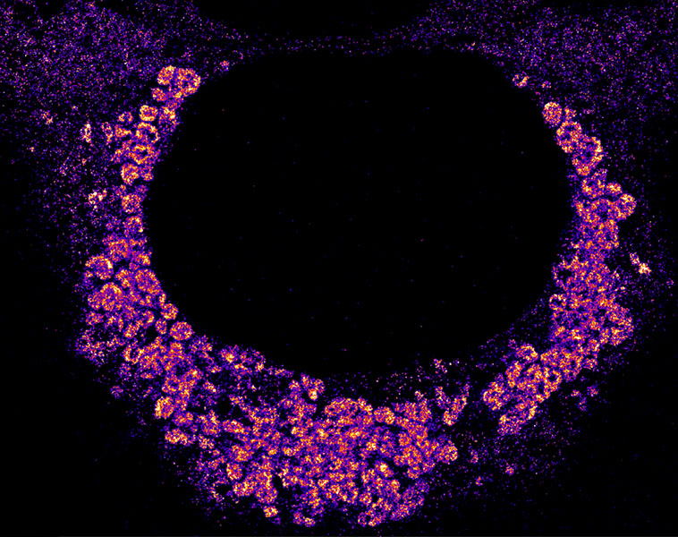 Una línea gruesa en forma de U de aglomeraciones de color rosa brillante alrededor de un agujero negro.