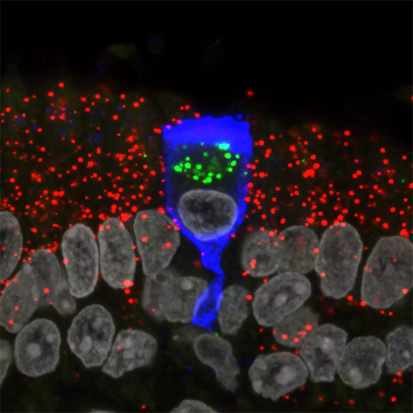 Micrografía de una célula en forma de copa teñida de azul