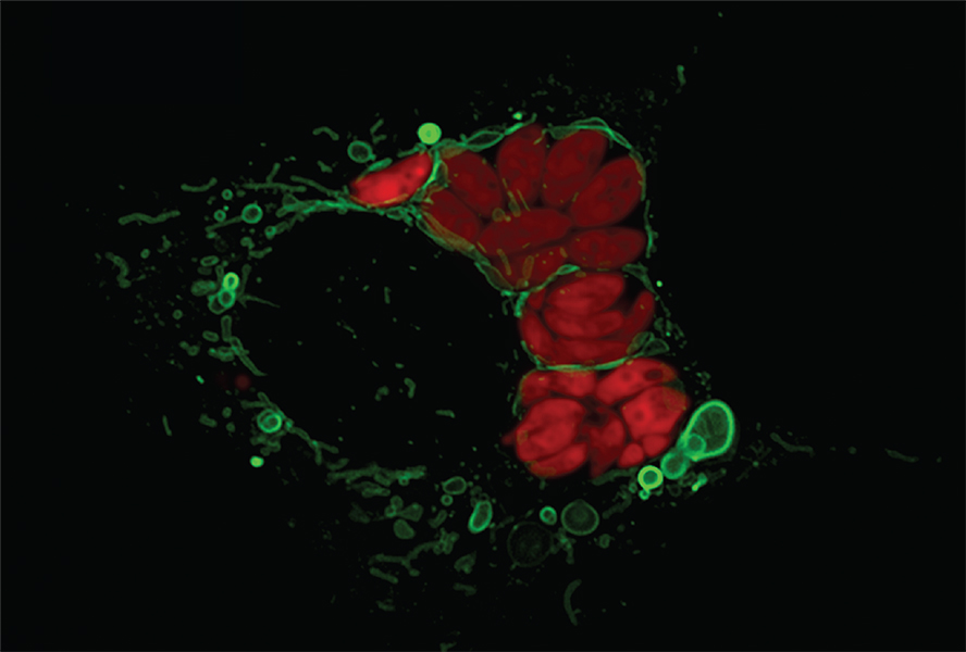 La imagen microscópica muestra grandes manchas rojas y pequeñas manchas verdes. Las verdes son mitocondrias. Se están liberando pequeñas vesículas verdes.