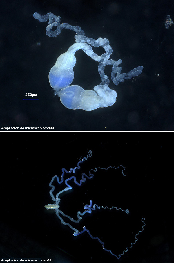 Foto de ovarios disecados (arriba) y glándulas venenosas (abajo), ambos de color azul pálido, sobre un fondo oscuro.