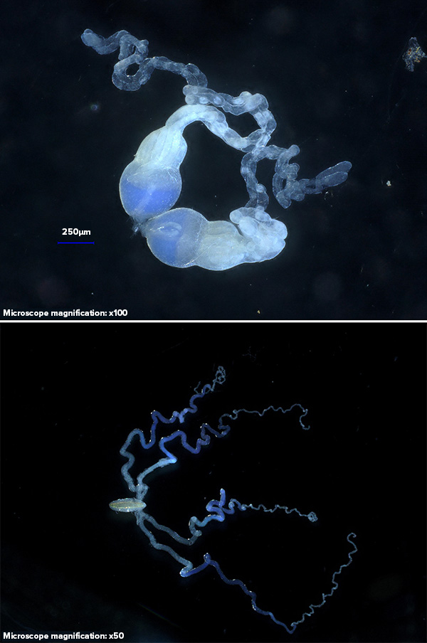 Photo of dissected ovaries (top) and venom glands (bottom), both pale blue in color, against a dark background.